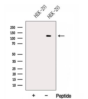 Polyclonal Rabbit anti-Human CEB1 / HERC5 Antibody (WB)
