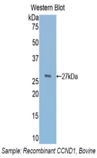 CCND1 / Cyclin D1 Antibody (aa72-272)