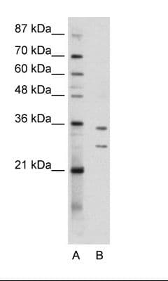 Polyclonal Rabbit anti-Human BXDC5 / RPF1 Antibody (aa45-94, IHC, WB)