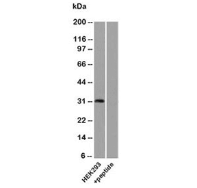 UPK3A / UPK3 / Uroplakin III Antibody (aa260-279)