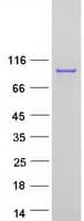 Human VIL1 / Villin Protein (Recombinant Myc-DDK (Flag))