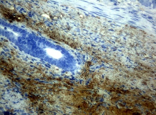 HP / Haptoglobin Antibody (clone UMAB10, Carrier-free)