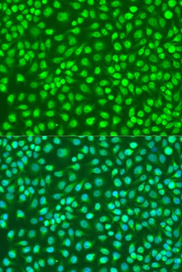 IKBKB / IKK2 / IKK Beta Antibody