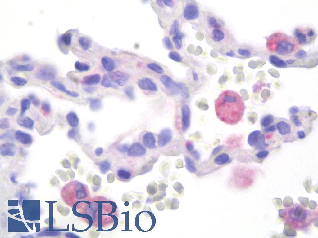 IHC-plus™ Monoclonal Mouse anti-Human HEXA Antibody (clone AT20F1, IHC, WB)
