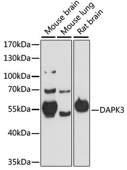 DAPK3 / ZIP Kinase Antibody