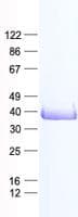 Human APEX1 / APE1 Protein (Recombinant His, N-Terminal)