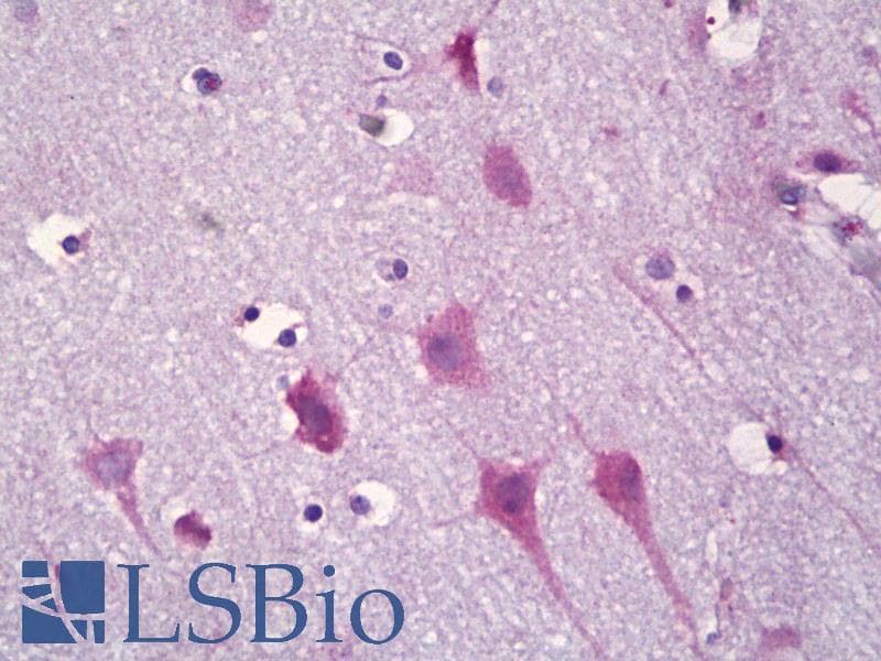 IHC-plus™ Polyclonal Rabbit anti-Human KCNIP3 / Dream / Calsenilin Antibody (aa29-78, IHC, IF, WB)