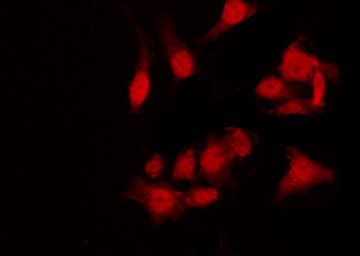 Polyclonal Rabbit anti-Human CLIC4 Antibody (IHC, IF, WB)