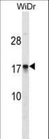 Polyclonal Rabbit anti-Human CDRT4 Antibody (aa50-79, WB)