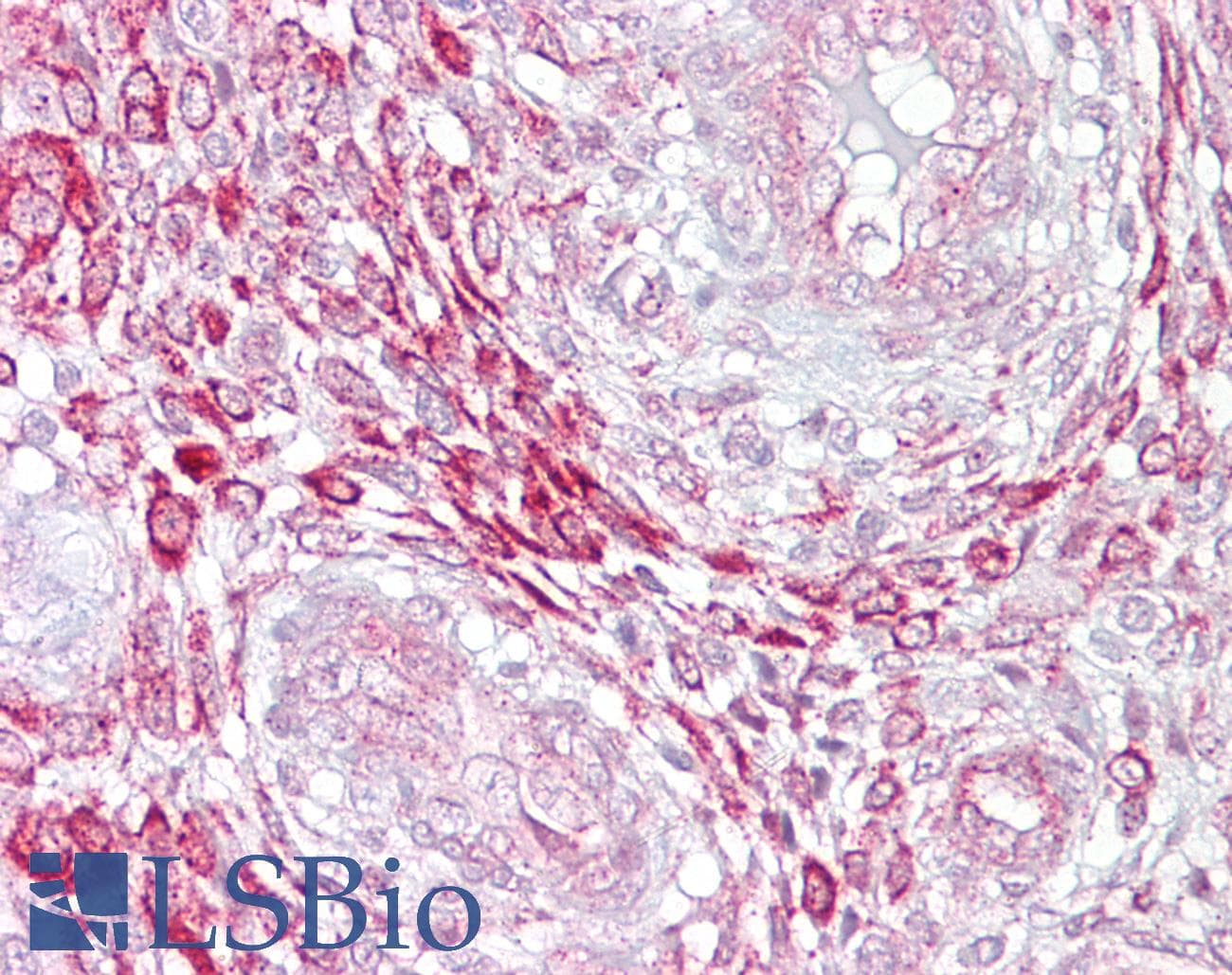 Polyclonal Rabbit anti-Human TGFB4 / LEFTY2 Antibody (N-Terminus, IHC, WB)