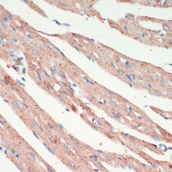 LRRK2 Antibody