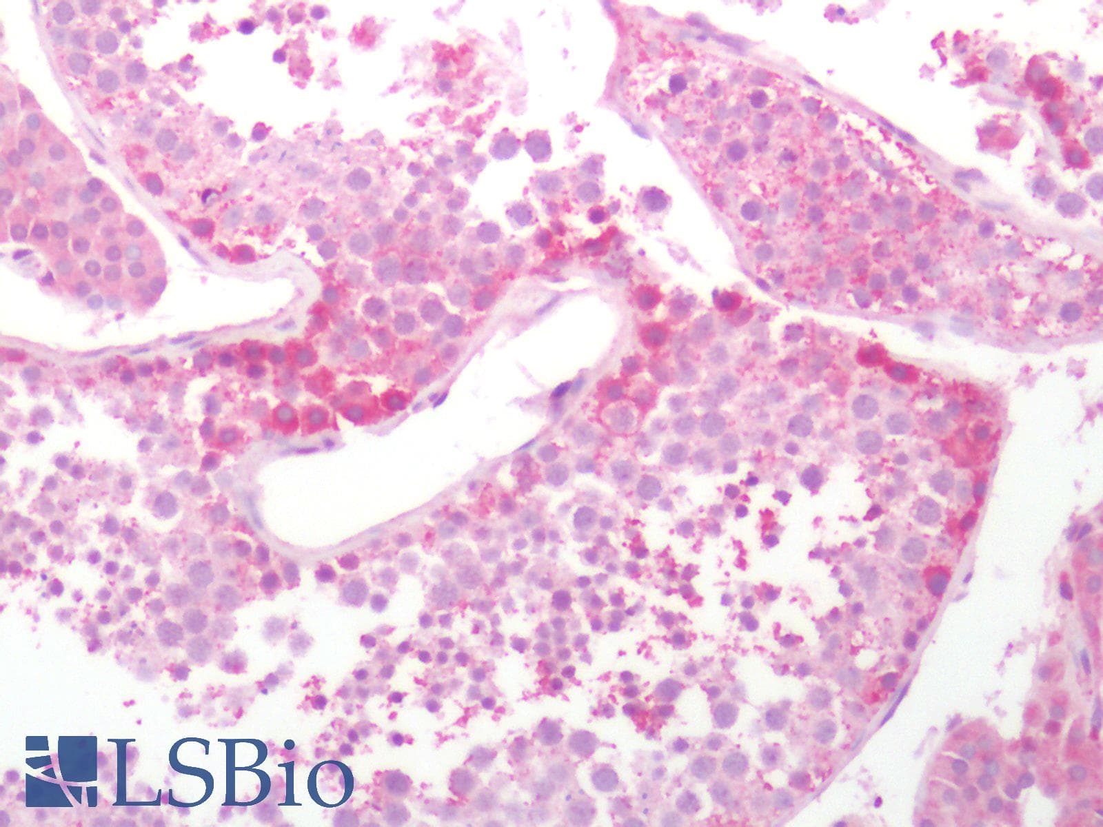 IHC-plus™ Polyclonal Rabbit anti-Human SLC7A5 / CD98 Light Chain Antibody (Internal, IHC)