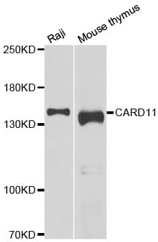 CARMA1 / CARD11 Antibody