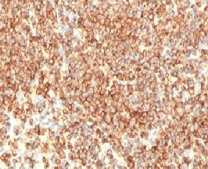 Monoclonal Mouse anti-Human CD20 Antibody (clone CDLA20-1, IHC, IF)