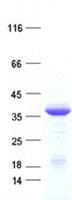 Human NSL1 Protein (Recombinant His, N-Terminal)