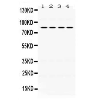 PIK3R2 / p85 Beta Antibody (aa427-463)