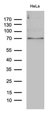Monoclonal Mouse anti-Human PPM1D / WIP1 Antibody (clone OTI3E1, aa1-375, WB)