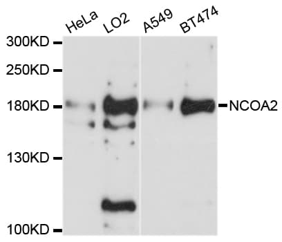 NCOA2 / TIF2 Antibody