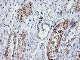 SIRT5 / Sirtuin 5 Antibody (clone OTI2F1)
