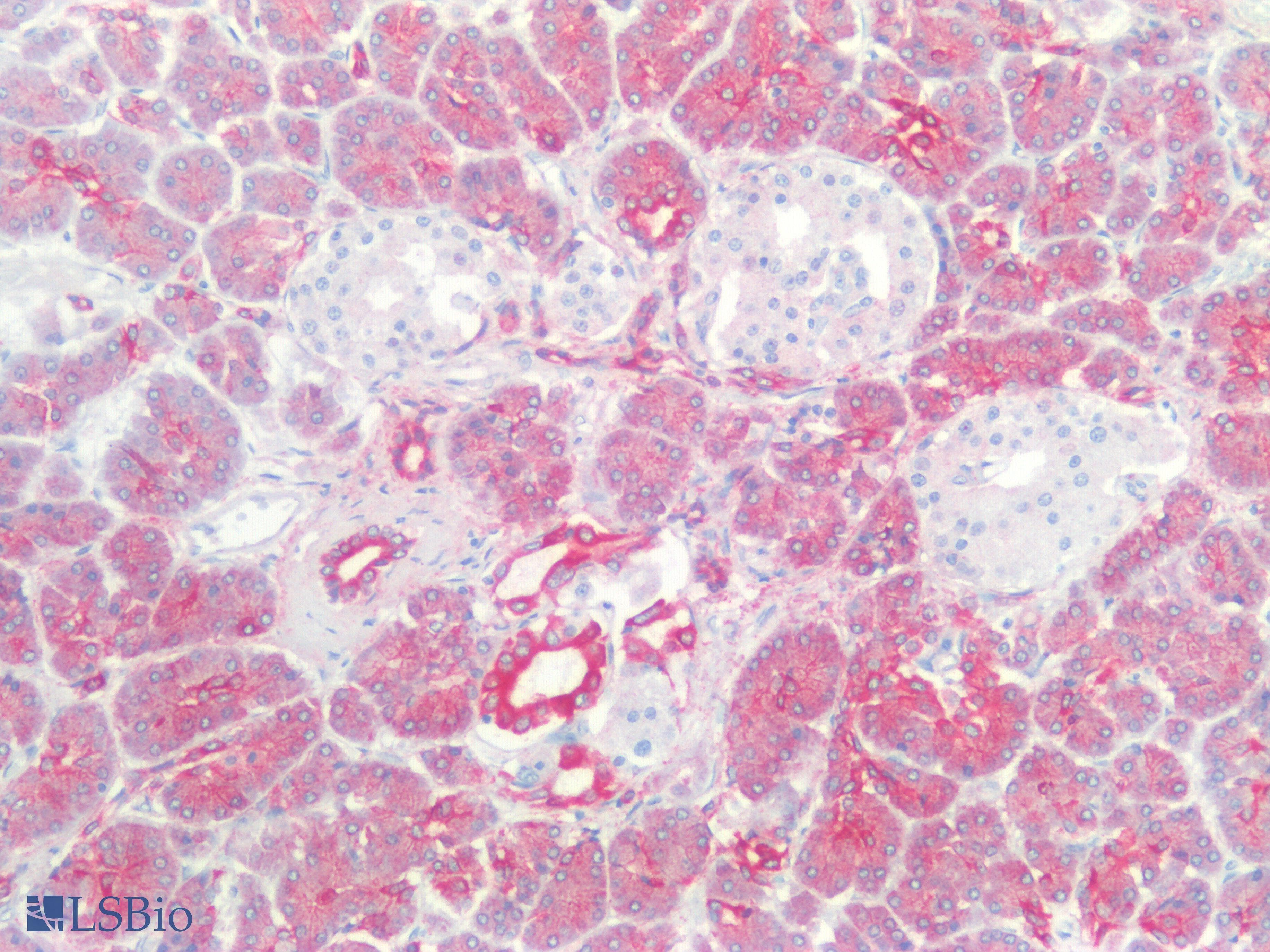 PathPlus™ KRT18 / CK18 / Cytokeratin 18 Antibody