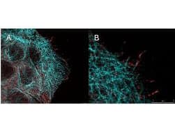 AKT1 Antibody (phospho-Ser473, clone 17F6.B11)