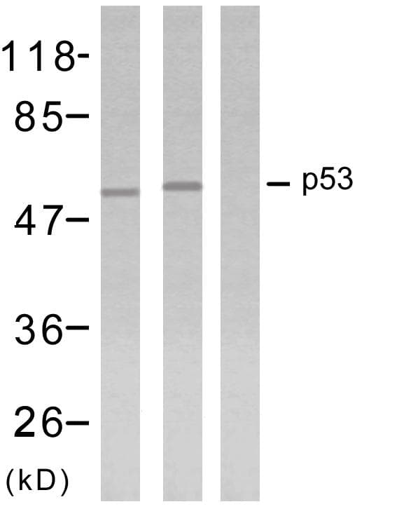 TP53 / p53 Antibody (p18)