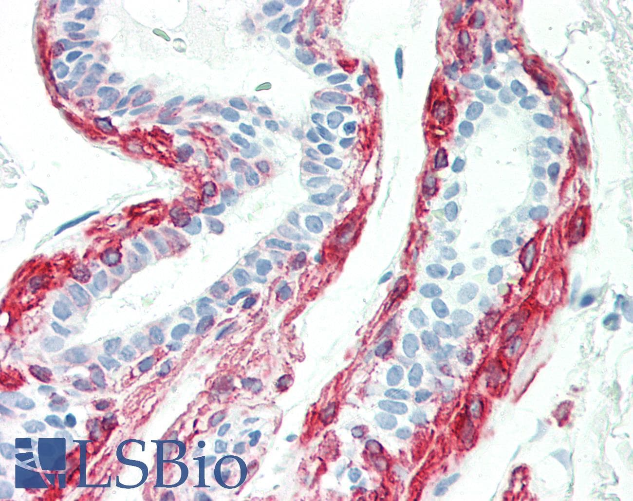 PathPlus™ KRT17 / CK17 / Cytokeratin 17 Antibody