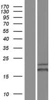 Human UBE2K / LIG Protein (Over-Expression Lysate Myc-DDK (Flag))