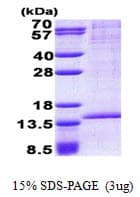 Human RAB8B Protein (Recombinant His)
