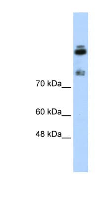 Polyclonal Rabbit anti-Human HDLBP / Vigilin Antibody (N-Terminus, IHC, WB)