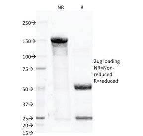 FOLH1 / PSMA Antibody (clone FOLH1/2363)