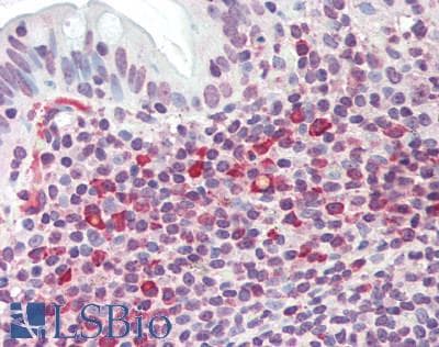 IHC-plus™ TIGIT Antibody (clone 3B5)