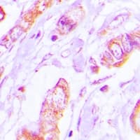 TPM2 Antibody