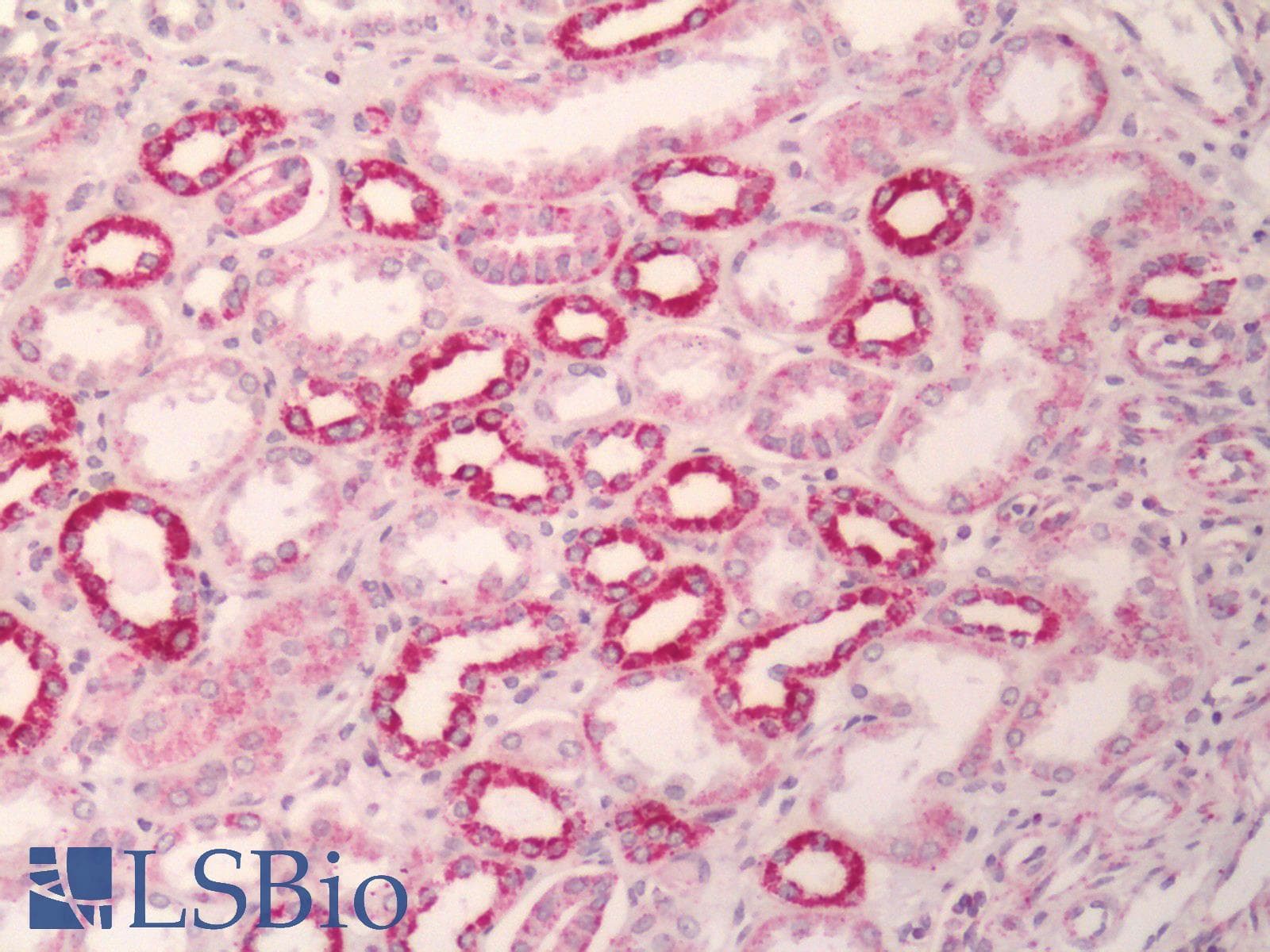 IHC-plus™ Polyclonal Rabbit anti-Human MC1R Antibody (Cytoplasmic Domain, IHC)
