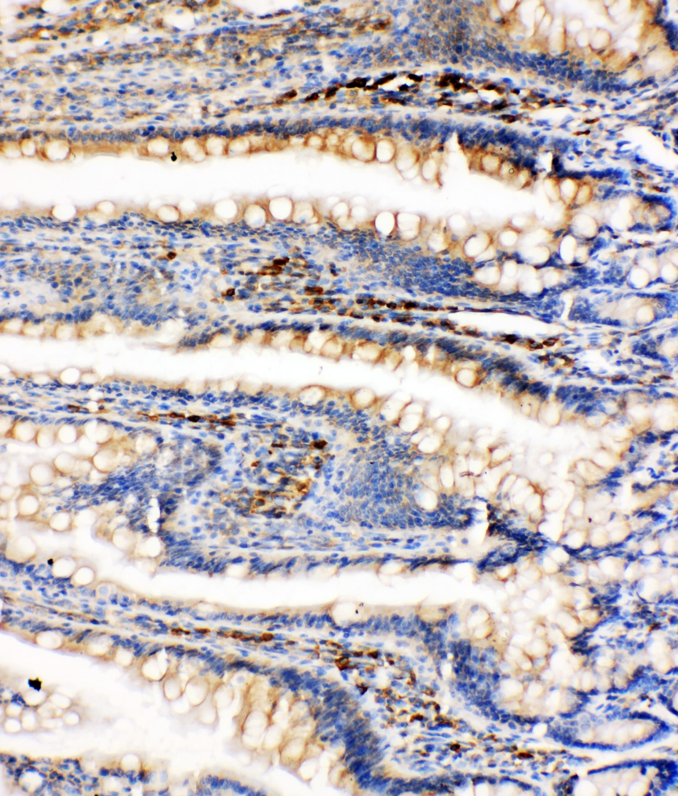 HSPA5 / GRP78 / BiP Antibody (aa603-617)