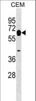 MYOT / Myotilin Antibody (aa127-155)