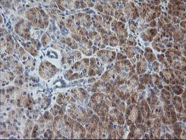 RAB30 Antibody (clone OTI3E7)