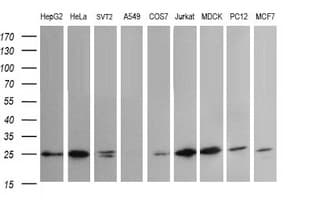 VTI1A Antibody (clone OTI1F4)
