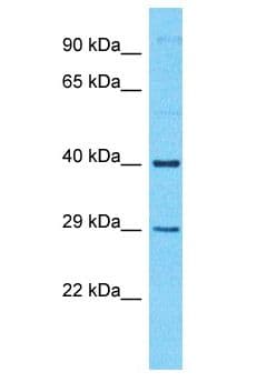 TTC34 Antibody (aa74-123)