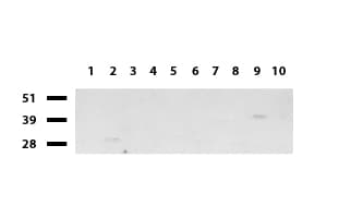 BBOX1 / BBOX Antibody (clone UMAB119, Carrier-free)