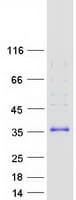 Human FHL3 Protein (Recombinant Myc-DDK (Flag))