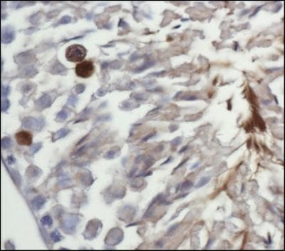 MAP1LC3A / LC3A Antibody