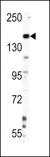 NES / Nestin Antibody (Ser1409)