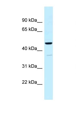 UQCRC1 Antibody (aa84-133)