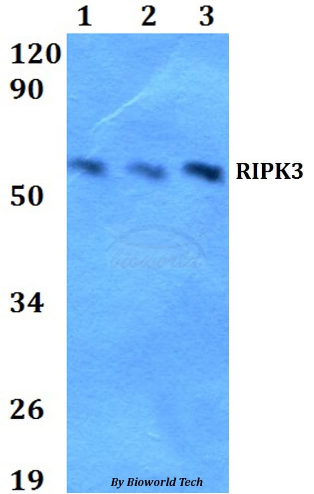 RIPK3 / RIP3 Antibody