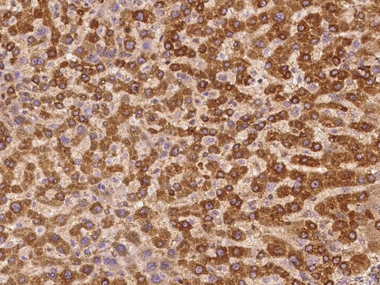 Polyclonal Rabbit anti-Human EIF4G1 / EIF4G Antibody (IHC, IF)