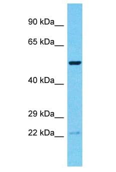 RNF19B Antibody (aa381-430)