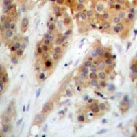 CHEK1 / CHK1 Antibody (phospho-Ser345)