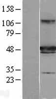 IFT57 / HIPPI Protein (Over-Expression Lysate Myc-DDK (Flag))