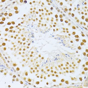 SIRT1 / Sirtuin 1 Antibody